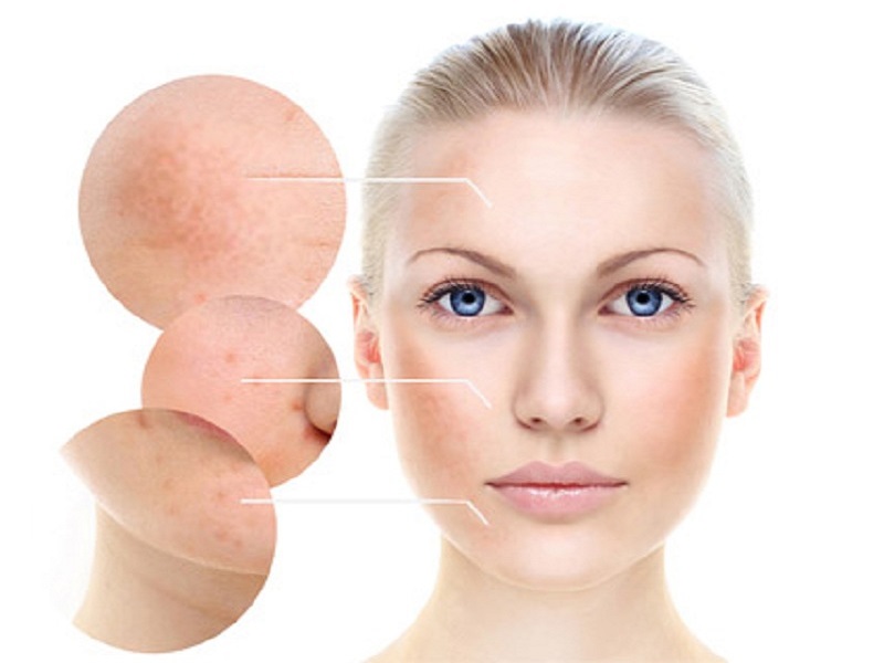 Close-up of skin texture variations.